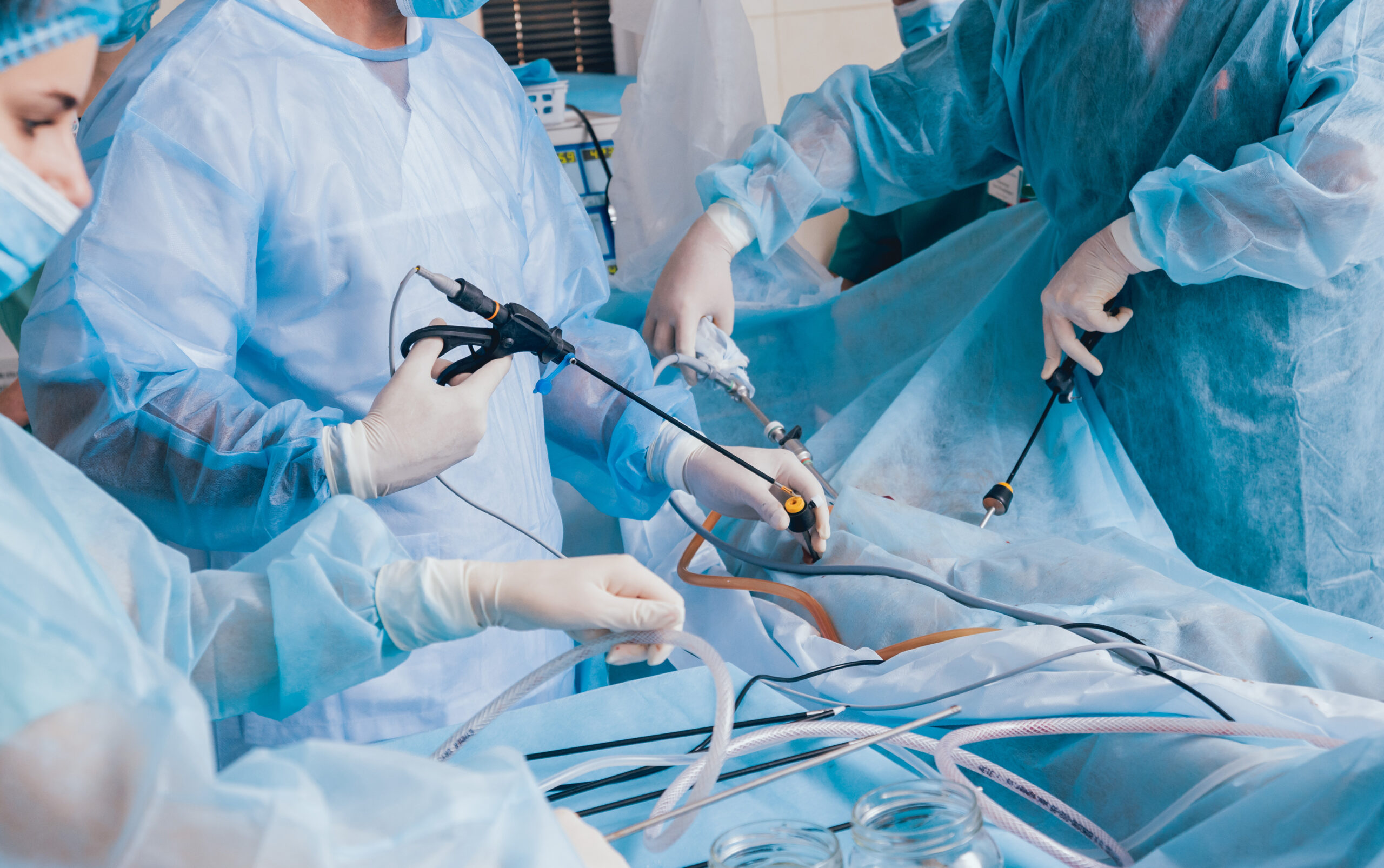 Laparoscopy